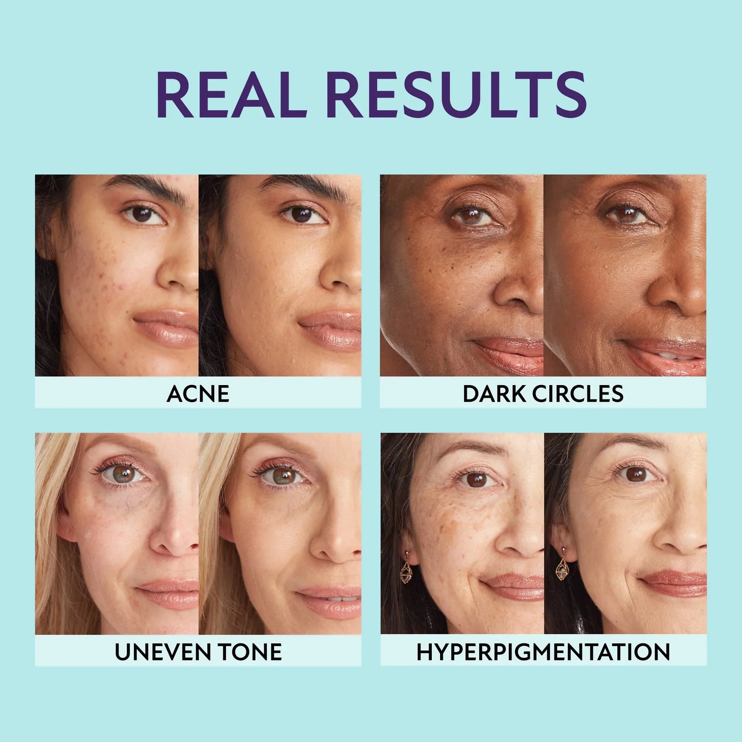 🔥The last-day limited-time discount--🔥Guitarrra All Over Complexion Perfector