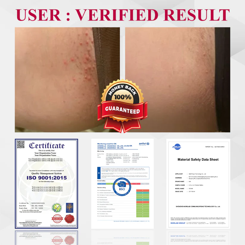 Woman's Genital HPV Healing Cream (BUY 1 GET 1 FREE)