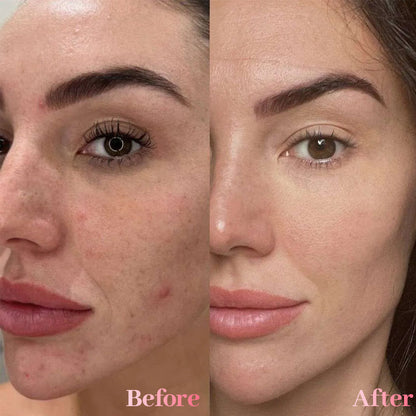 🔥 60% OFF Today Only!  Medicuba™ Spray Serum for Dullness, Dark Spots & Uneven skin tone, Korean skin care