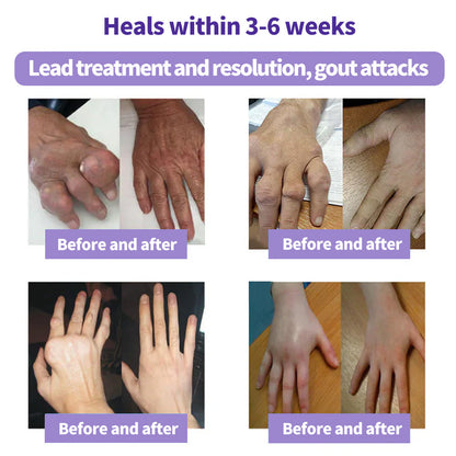 Kraein™ Turmeric & Emu Oil Arthritis Soothing Pain Relief Massage Gel 👨‍⚕️Australian Osteopathic Association （AOA）Approved