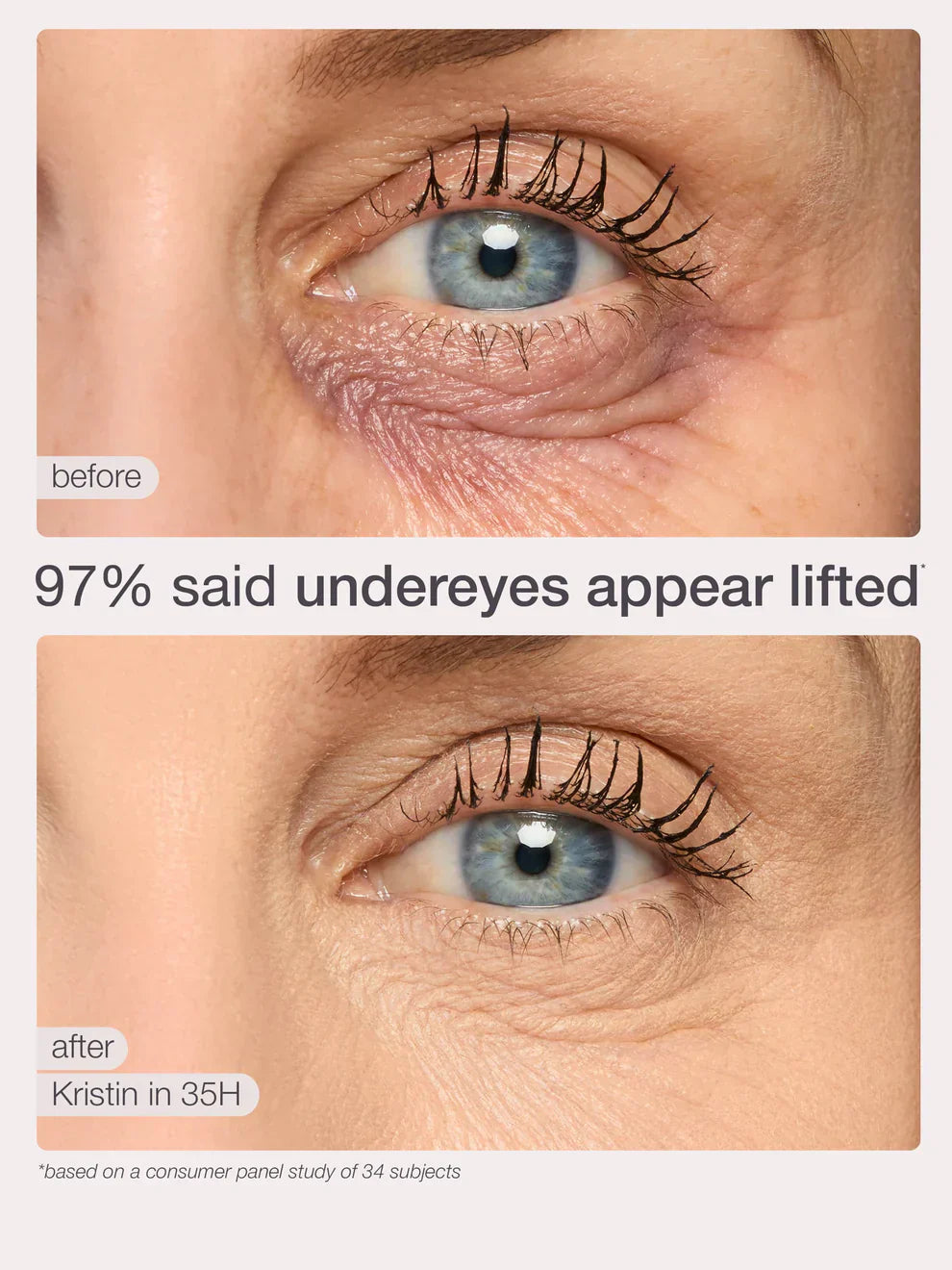 Blur It Like Magic – Skincare Meets Concealer in One Game-Changing Stick