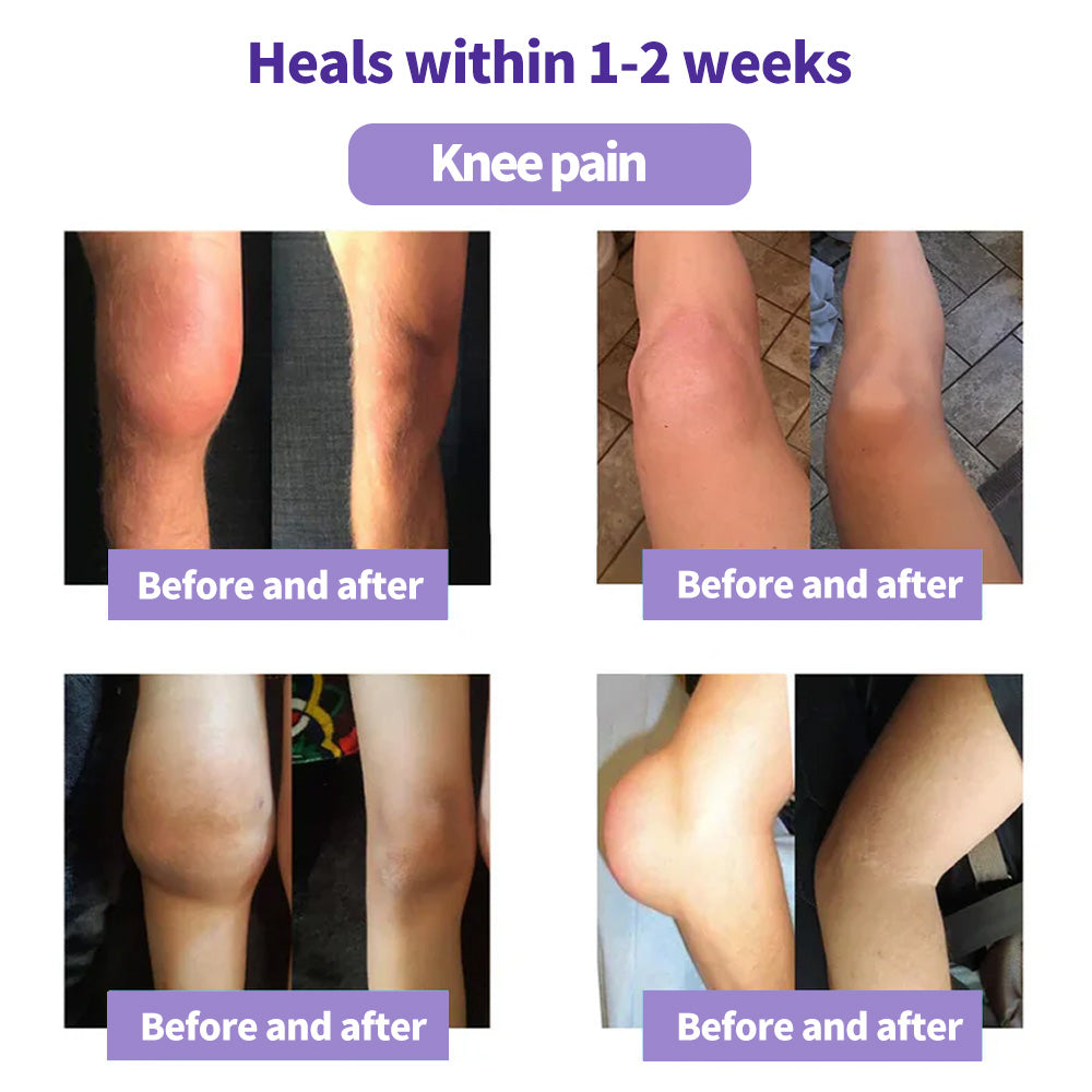 Kraein™ Turmeric & Emu Oil Arthritis Soothing Pain Relief Massage Gel 👨‍⚕️Australian Osteopathic Association （AOA）Approved