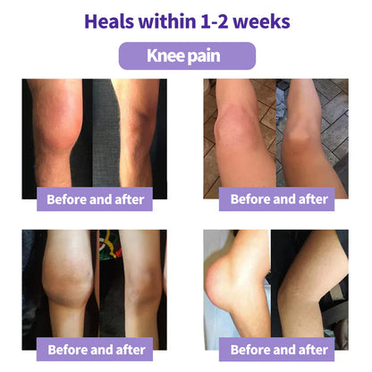 Kraein™ Turmeric & Emu Oil Arthritis Soothing Pain Relief Massage Gel 👨‍⚕️Australian Osteopathic Association （AOA）Approved