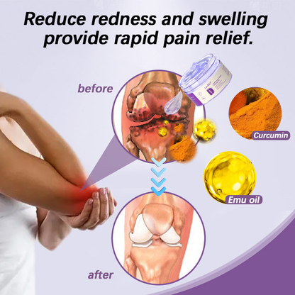 Kraein™ Turmeric & Emu Oil Arthritis Soothing Pain Relief Massage Gel 👨‍⚕️Australian Osteopathic Association （AOA）Approved