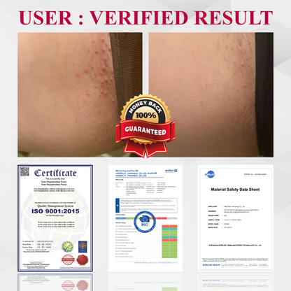 Woman's Genital HPV Healing Cream (BUY 1 GET 1 FREE)